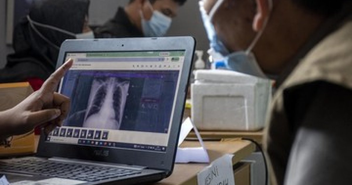 Langkah Praktis Cegah TB: Warga Kawasan Industri Karst Bandung Barat Dapatkan Skrining Kesehatan Gratis
