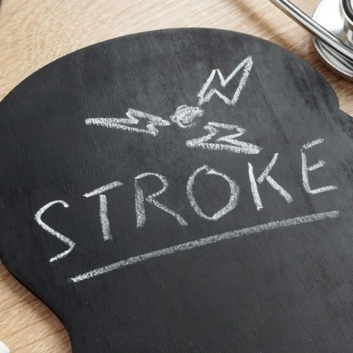 Mahasiswi Muda Terkena Stroke Mendadak, Kombinasi Faktor Jantung dan Kontrasepsi Jadi Sorotan Utama